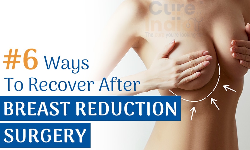 6 Ways to Recover After a Breast Reduction Surgery